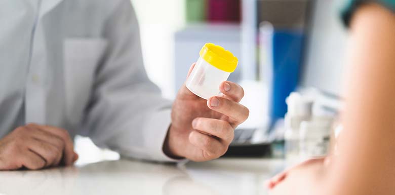 Doctor handing person drug test sample cup