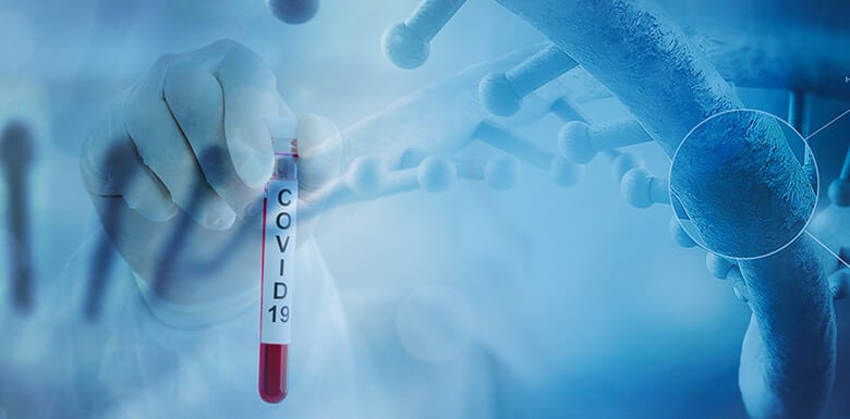 Covid-19 laboratory test